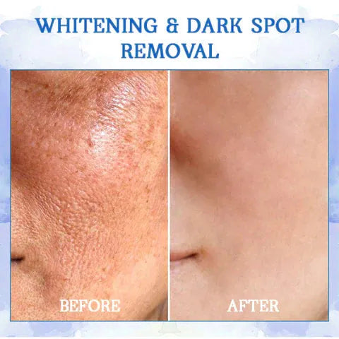 💫💫 𝐥𝐚𝐬𝐭 𝐝𝐚𝐲 𝐝𝐢𝐬𝐜𝐨𝐮𝐧𝐭 𝟕𝟓% 𝐎𝐅𝐅 🍀 𝐂𝐨𝐨𝐥𝐨𝐫𝐝™ Advanced Firming Cream: återställer hudens elasticitet och motverkar rynkor och slapphet.