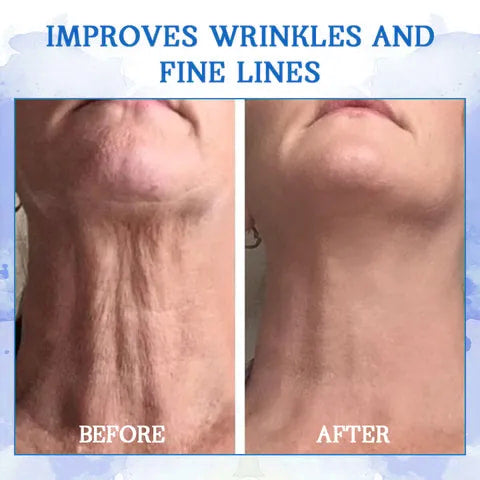 💫💫 𝐥𝐚𝐬𝐭 𝐝𝐚𝐲 𝐝𝐢𝐬𝐜𝐨𝐮𝐧𝐭 𝟕𝟓% 𝐎𝐅𝐅 🍀 𝐂𝐨𝐨𝐥𝐨𝐫𝐝™ Advanced Firming Cream: återställer hudens elasticitet och motverkar rynkor och slapphet.