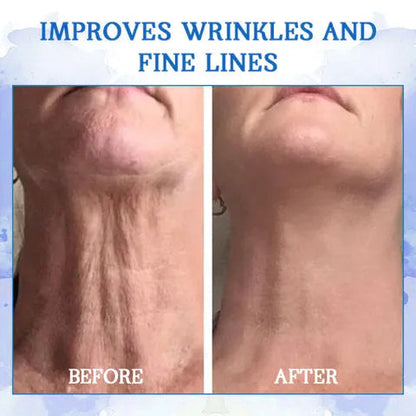 💫💫 𝐥𝐚𝐬𝐭 𝐝𝐚𝐲 𝐝𝐢𝐬𝐜𝐨𝐮𝐧𝐭 𝟕𝟓% 𝐎𝐅𝐅 🍀 𝐂𝐨𝐨𝐥𝐨𝐫𝐝™ Advanced Firming Cream: återställer hudens elasticitet och motverkar rynkor och slapphet.